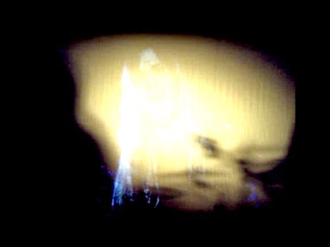 NOISE - All Those Dreams