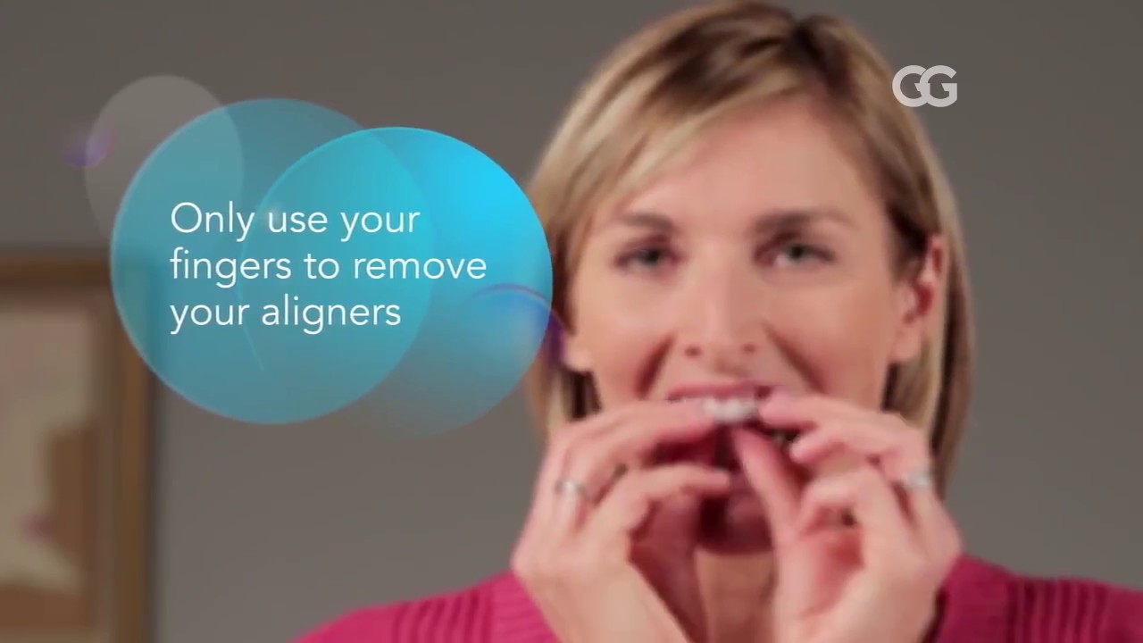 Aparelho Invisalign: dicas de cuidados e manutenção