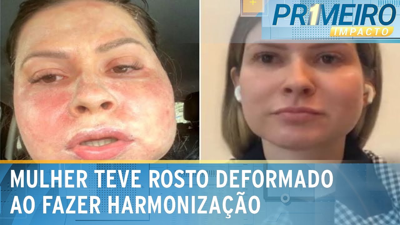Mulher com sequelas de procedimento estético apela por mais fiscalização| Primeiro Impacto(09/12/24)
