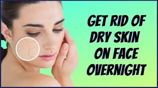 How To Get Rid Of Dry Skin On Face Overnight Home Remedies (100% Results)