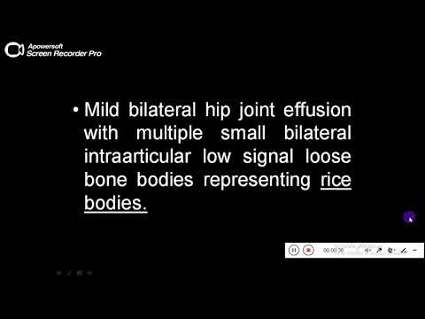 Quiz powerpoint video - Case 173- Refresh your knowledge