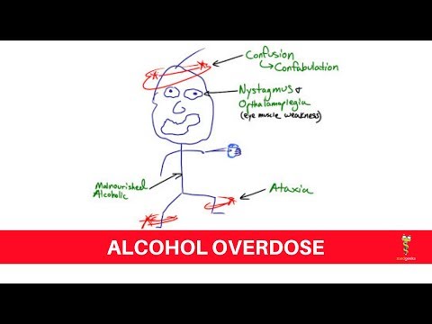 Acute Alcohol Intoxication