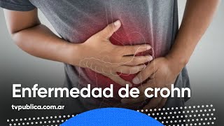 Diagnóstico y tratamiento de la enfermedad de Crohn – En Casa Salud