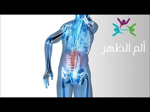 Mieux vaut prévenir que guérir – Épisode 10 – Mal de dos