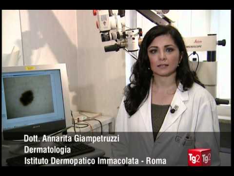 Maschere da macchie scure su una faccia Come togliere un posto di pigmentary da una cicatrice