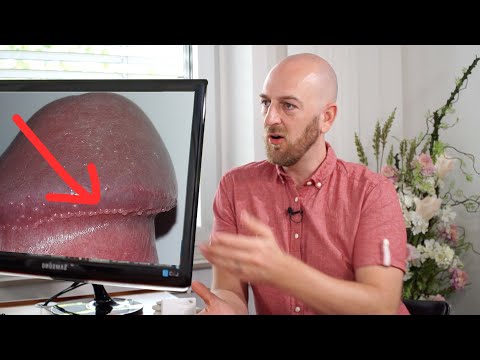 Pickel am Penis - Hornzipfel - beim Urologen