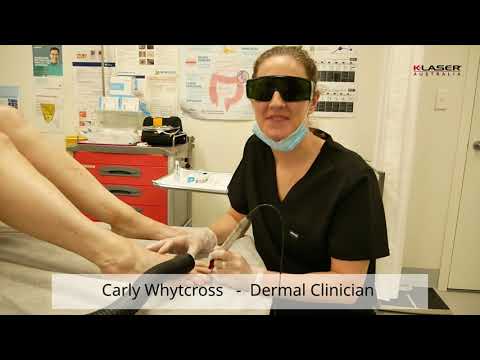K-Laser Blue Derma - Presentation Carly Whytcross - Onychomycosis