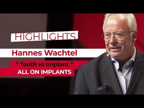 All On Implants