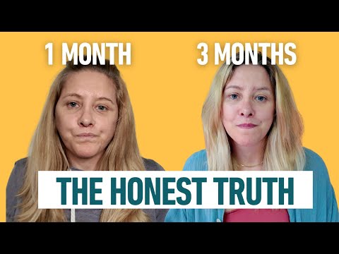 3 Months After My Facelift: What Healing Really Looks Like