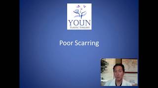 How Can I Improve My Scars After Breast Surgery - Scar Treatment Consultation - Dr. Anthony Youn