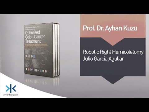 3.1.5. Robotic Right Hemicolectomy - Julio Garcia - Aguliar