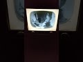 The Secret Of NIMH 1982 Ending Credits 1955 Sylvania Halolight TV