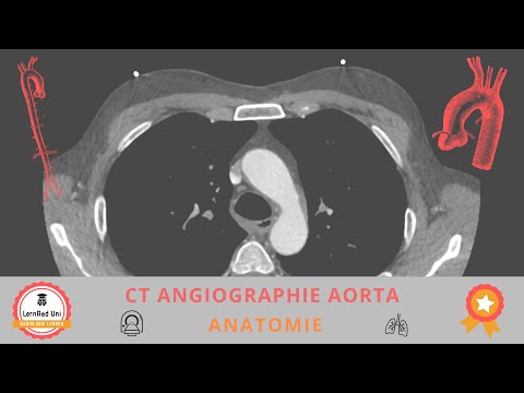 CT-Angiographie verstehen: Aorten-Anatomie systematisch erklärt