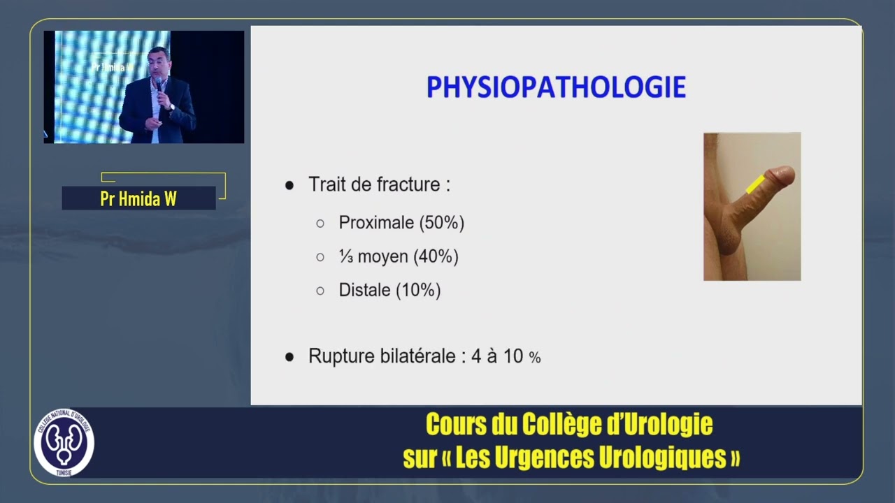 La fracture de la verge