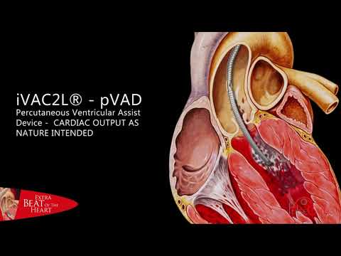 PulseCath iVAC2L -pVAD animation