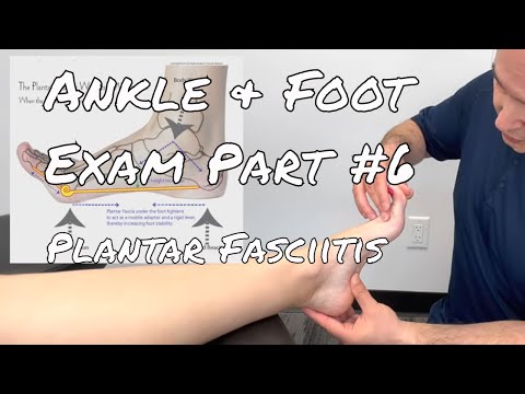 Ankle & Foot Exam Part #6 - Plantar Fasciitis