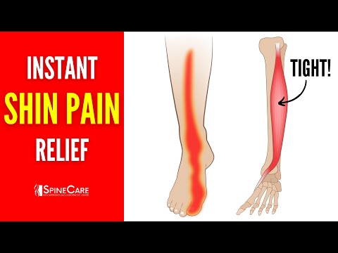 How to Instantly Relieve Shin Pain