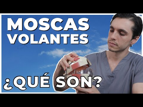 Do you have spots or black dots floating in your eyes? | 🪰 Floaters or Myodesopsia