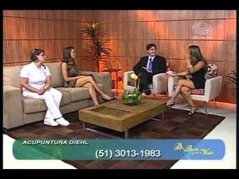 Acupuntura e Enxaqueca - Dr. Diego Diehl na Ulbra TV EffectivePhysio