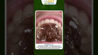Download lagu పంటినొప్పిని తగ్గించే చిట్కాలు..| Home Remedies For Teeth Pain | Oxy Dental mp3