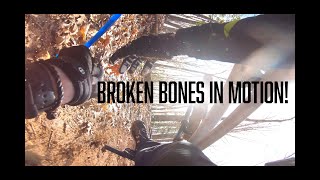 Hard Crashes Broken Bones and other great lessons Every Mountain Biker should know