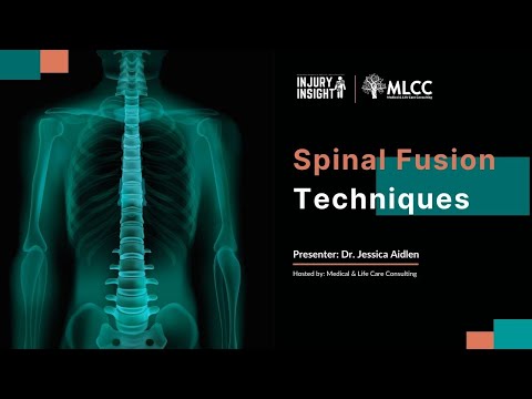 Spinal Fusion Techniques​
