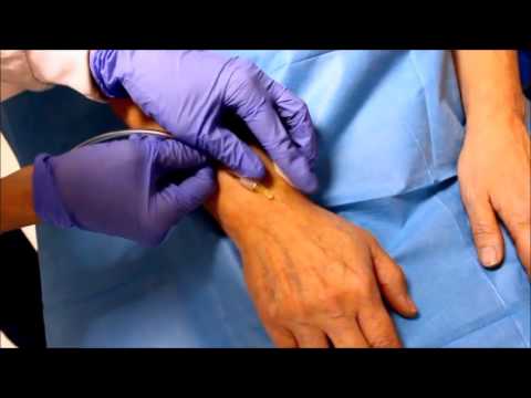 Stile di vita in osteocondrosi del collo Ritardo hip