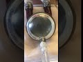Video Supplementa 1a, iPhone in the Management of the Berlin Heart EXCOR VAD