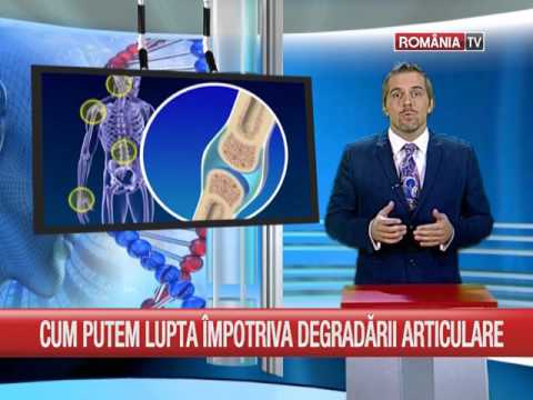 Unguente reumatoide pentru articulații