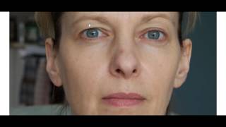 New Facial Signs of Thyroid Issues to Watch For (60 Sec)