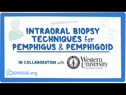 Endodontic Diagnosis in Collaboration w Western University