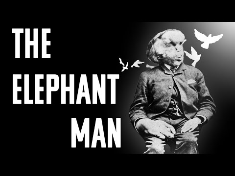 Joseph Merrick | Over the Cuckoo's Nest #3