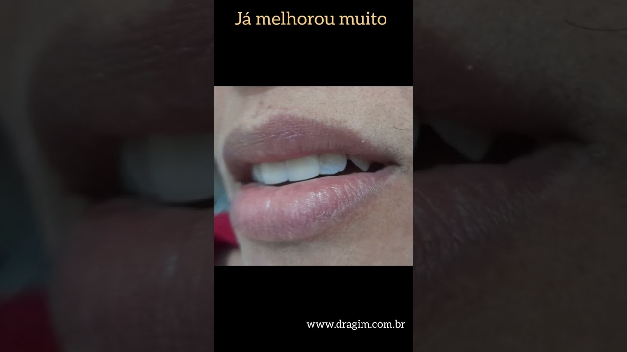 Gislene Isabel De Mendonça-26