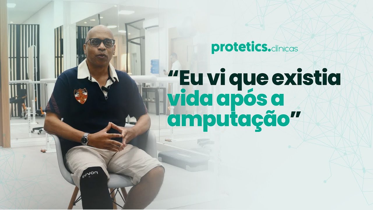 Superação e Coragem: Veja Como Enfrentou o Mundo Após a Amputação – História Real e Inspiradora!