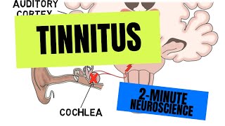 2-Minute Neuroscience: Tinnitus