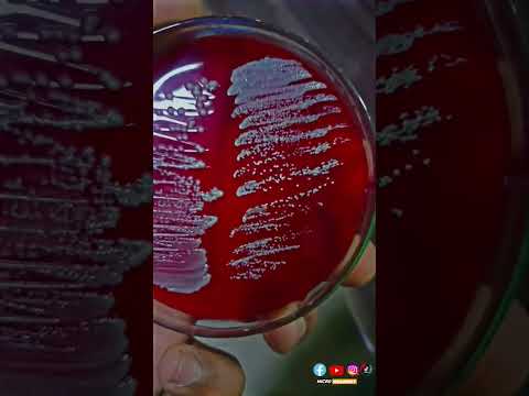 Staphylococcus aureus: The Superbug That's Hard to Kil || Staphylococcus aureus || #microbiologist