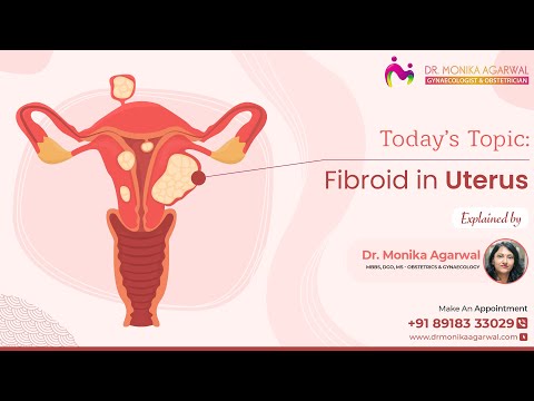 Fibroid in Uterus