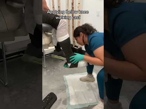 Applying Walking Cast #podiatrist