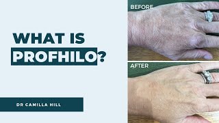 What is Profhilo? How does it work? | Dr Camilla Hill