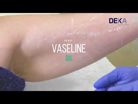 Onda Coolwaves - Body Contouring mit Microwellen - Hautstraffung