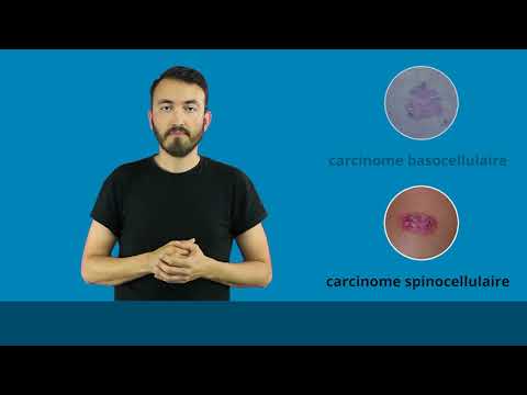 Le cancer de la peau
