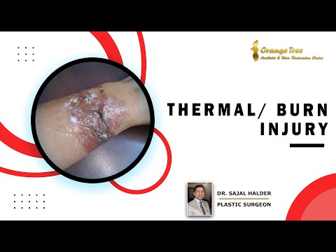 How to Treat Thermal Burn Injury & Prevent Skin Damage in Hindi? Dr. Sajal | Orange Tree Clinic