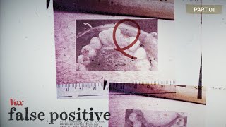 The murder: How one man's teeth made him a suspect
