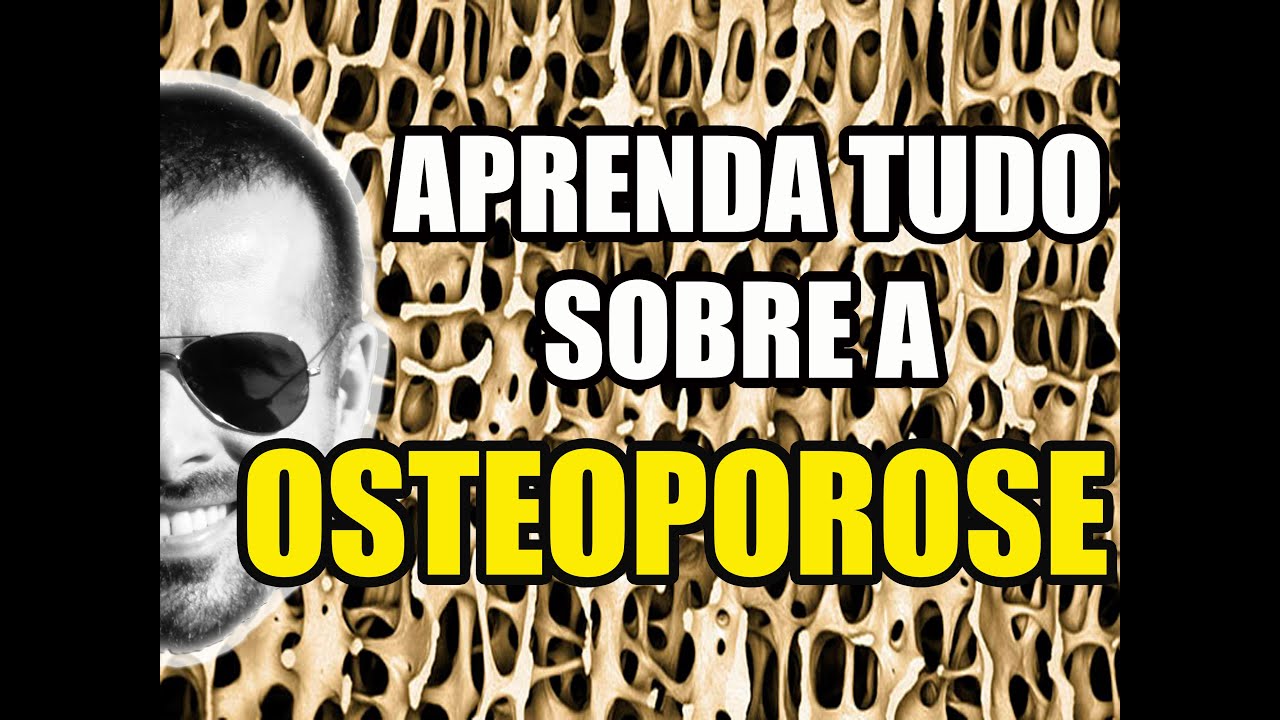 Vídeo Aula 126 - Osteoporose e Osteopenia: Doenças Ósteo Metabólicas - Osteologia - Anatomia Humana