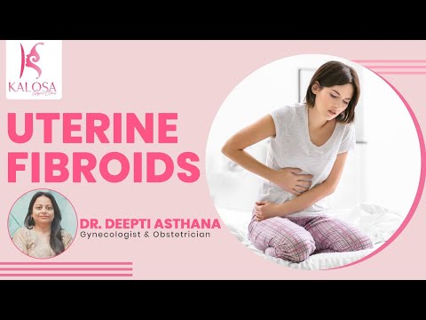 Uterine Fibroids : Causes, Signs, Symptoms & Treatment | Dr. Deepti Asthana
