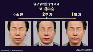 ������� 1�� ��� ��