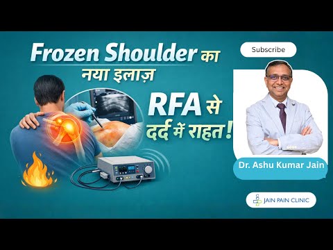 Watch video on Shoulder Joint RFA and Frozen Shoulder Release