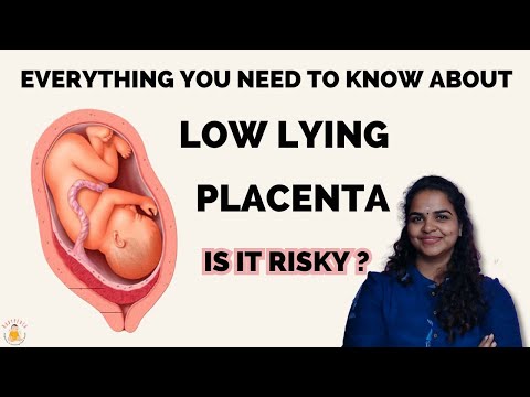 What is low lying placenta ? | Can Low Lying Placenta be dangerous to baby? | Placenta previa