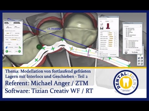 EXOCAD TUTORIAL Teaser - Model. von fortl. gefr. Lagern mit Interlocs und Geschieben Teil 2