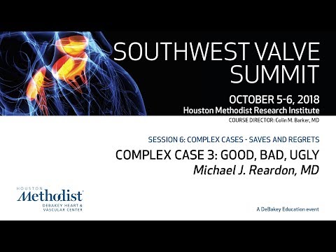 Complex Cases 3 & 4: Good, Bad, Ugly (Michael J. Reardon, MD)